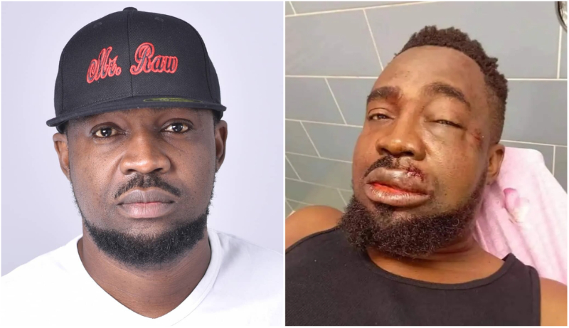 An image of Mr. Raw before and after his accident