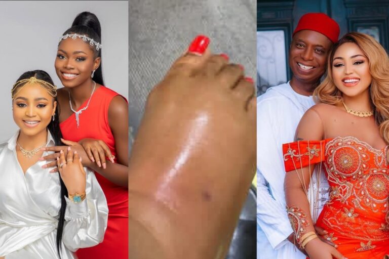 Regina Daniels’ Sister Slams Rumours of Reconciliation with Ned Nwoko, Shares Photos Of Her Scars